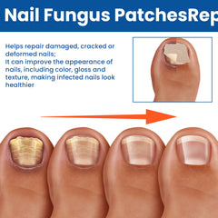 Nail Repair Bandage